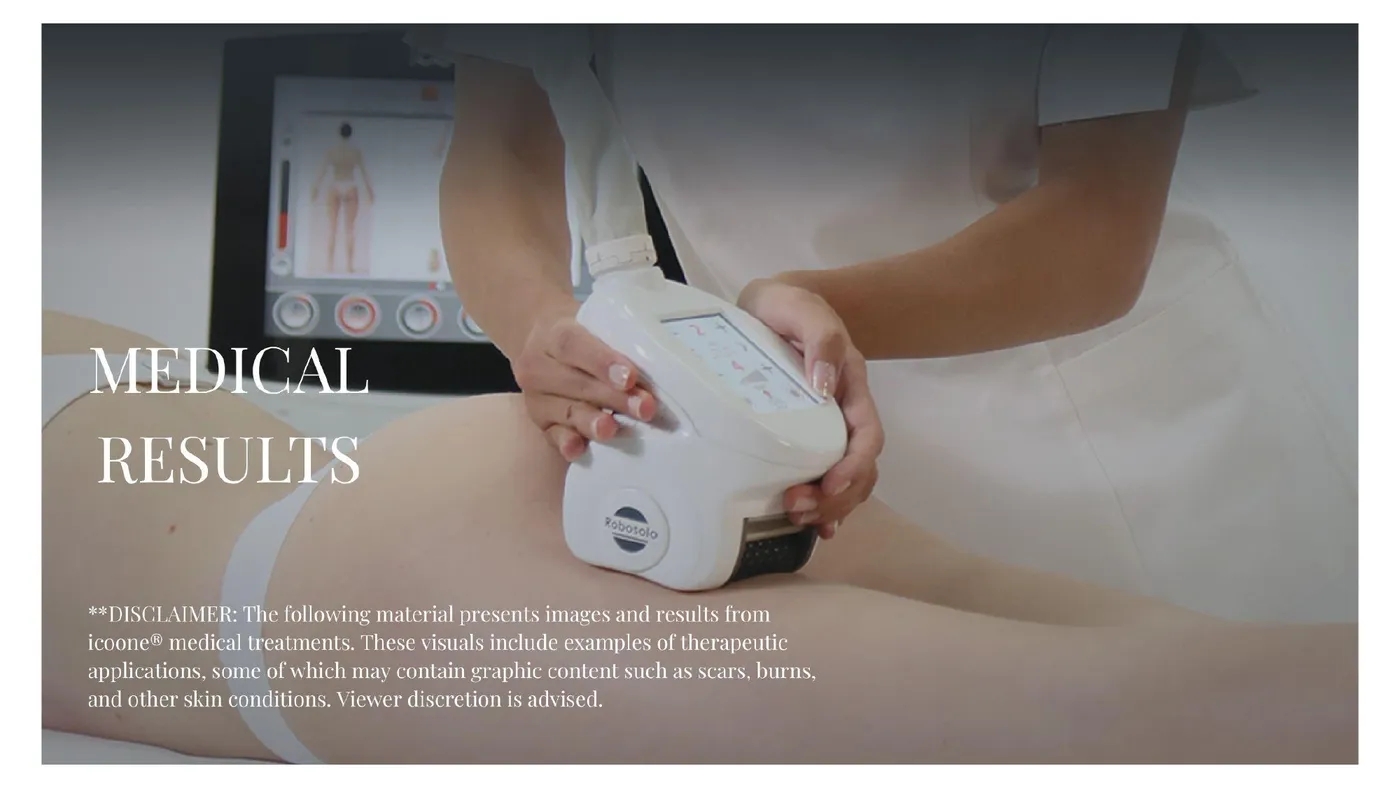 icoone® before and after — body firming, second documented case