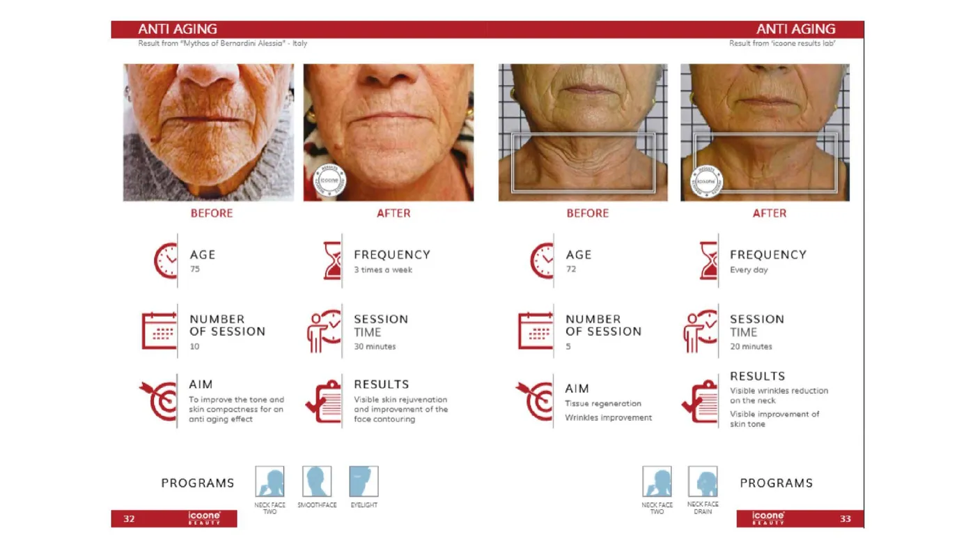 icoone® before and after — anti-ageing face results with session data