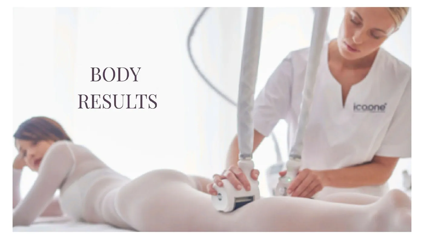 icoone® before and after — facial firming, second documented case