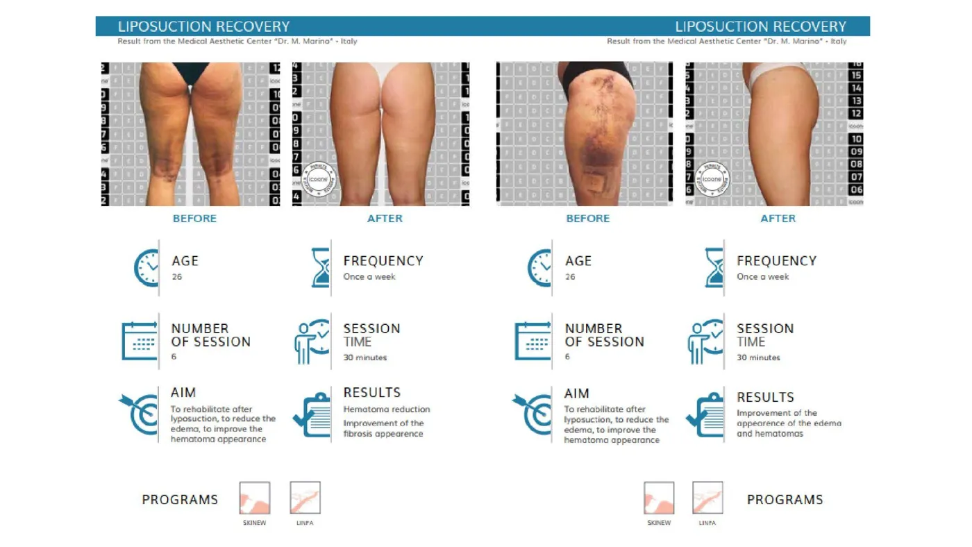 icoone® documented cases — post-surgery recovery, international